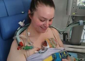 Baby Blake was born at 24 weeks weighing just 690 grams.