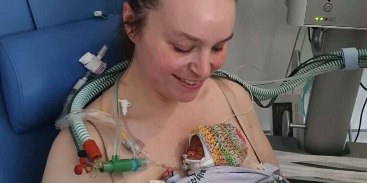 Baby Blake was born at 24 weeks weighing just 690 grams.